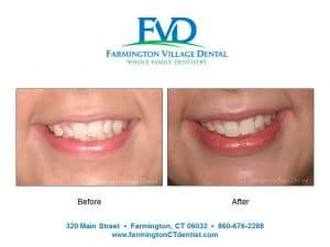 Orthodontics Farmington