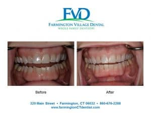 Orthodontics Farmington CT