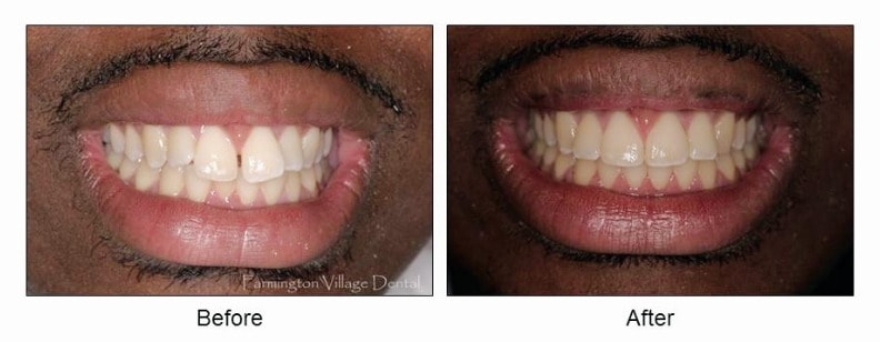 Michael Dental Before After Image