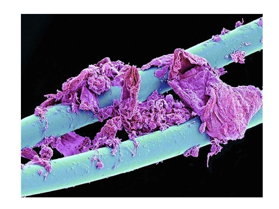 Used dental floss shows bacteria