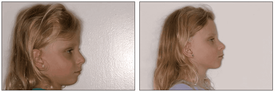 Dentist for Children Farmington CT