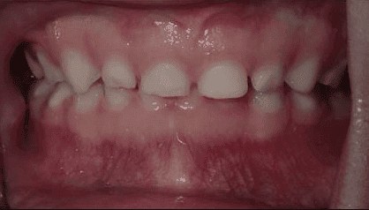 Pediatric Dentist Farmington CT
