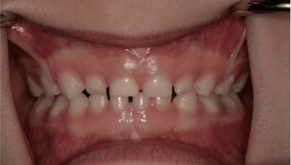 Pediatric Dentist Farmington CT