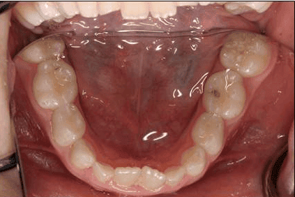 Pediatric Dentistry Farmington