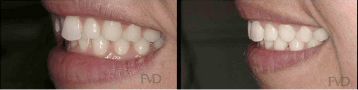 Orthodontics Farmington